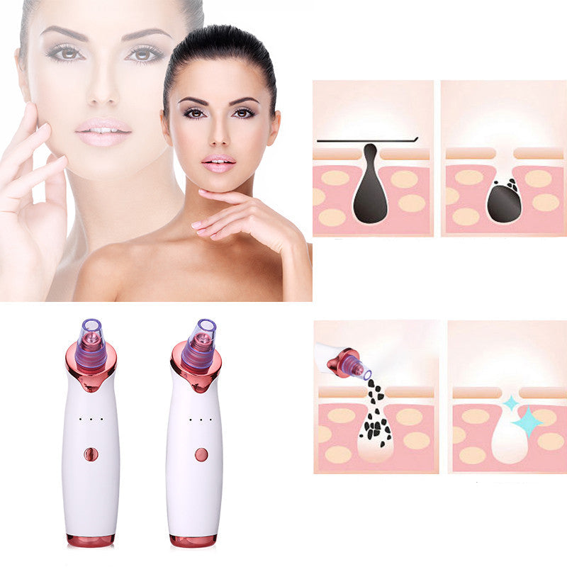 Blackhead Remover Instrument - Vacuum Suction Tool for Clearer Skin