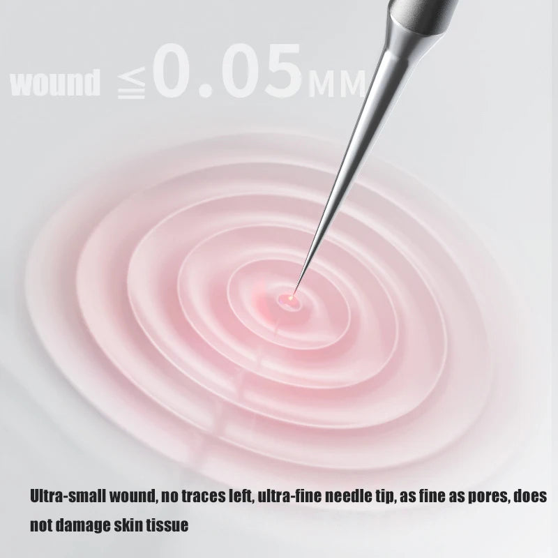 1pc German Ultra-fine Blackhead & Whitehead Removal Clip