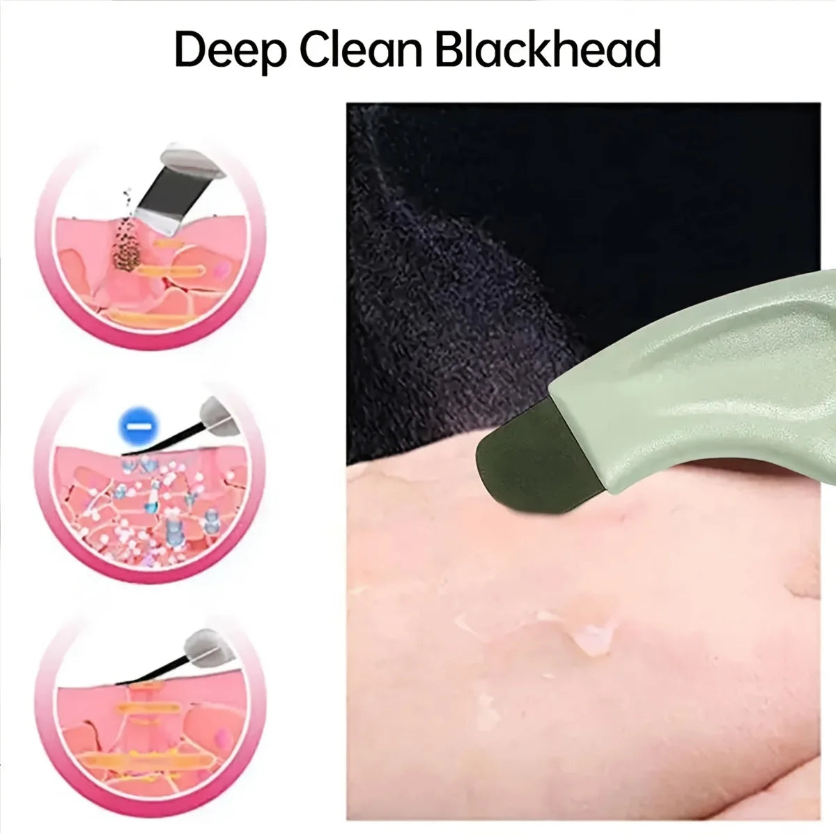 Facial Blackhead Removal & Acne Cleansing Handheld Beauty Tool