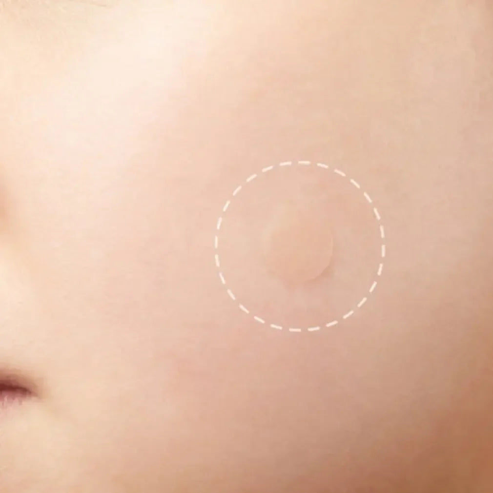 Closed Pimple Master Patch