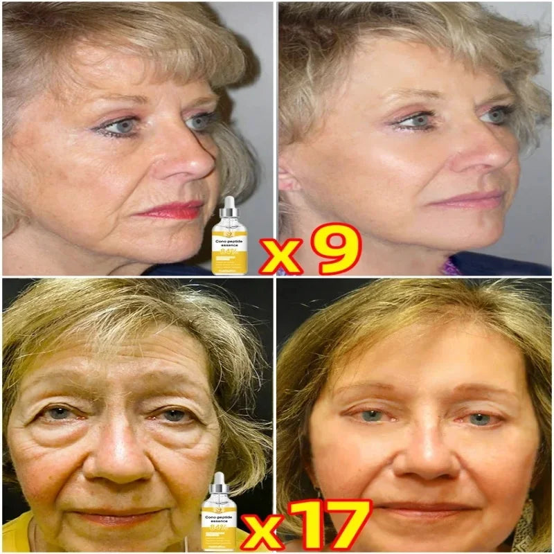 Anti-Aging Serum – Neck Wrinkle Remover & Collagen Boost