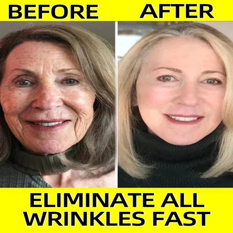 Anti-Aging Serum – Neck Wrinkle Remover & Collagen Boost
