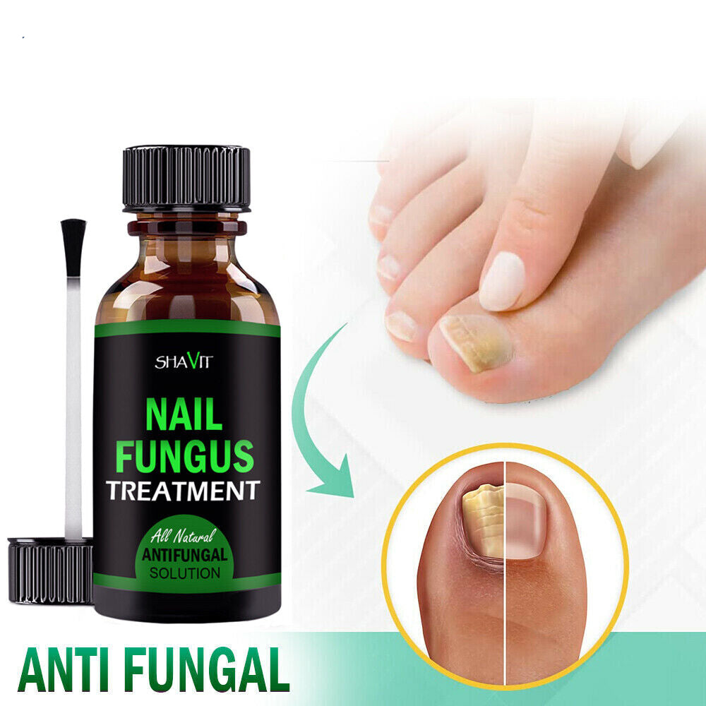 Anti-Fungal Treatment Extra Strength
